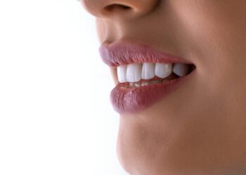 Solo And Looked after: A 36-Hour Dental Run To Los Algodones